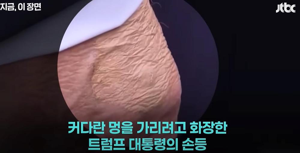 트럼프 대통령 몸 상태