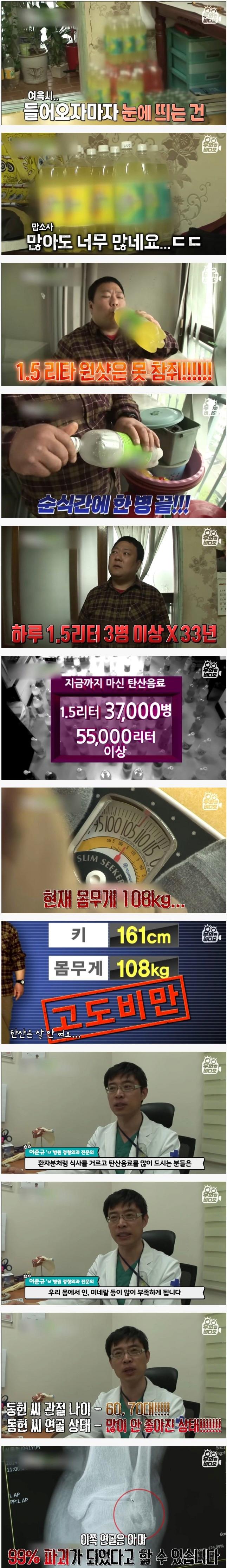 1.5리터짜리 탄산음료 하루 3병 마시는 사람의 몸 상태 ㄷㄷㄷ