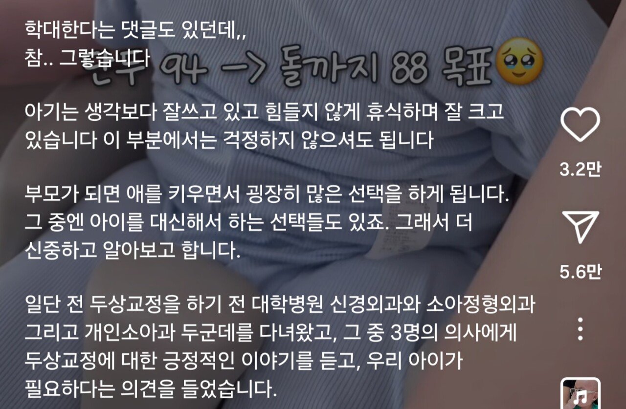 7개월 아기 두상교정