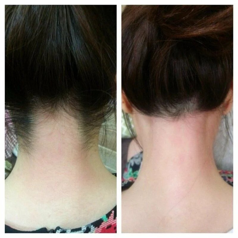 여자 왁싱후 인증 사진