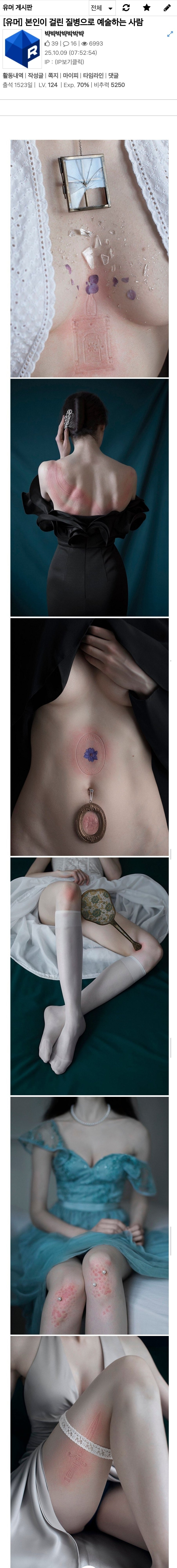 본인이 걸린 질병으로 예술하는 사람