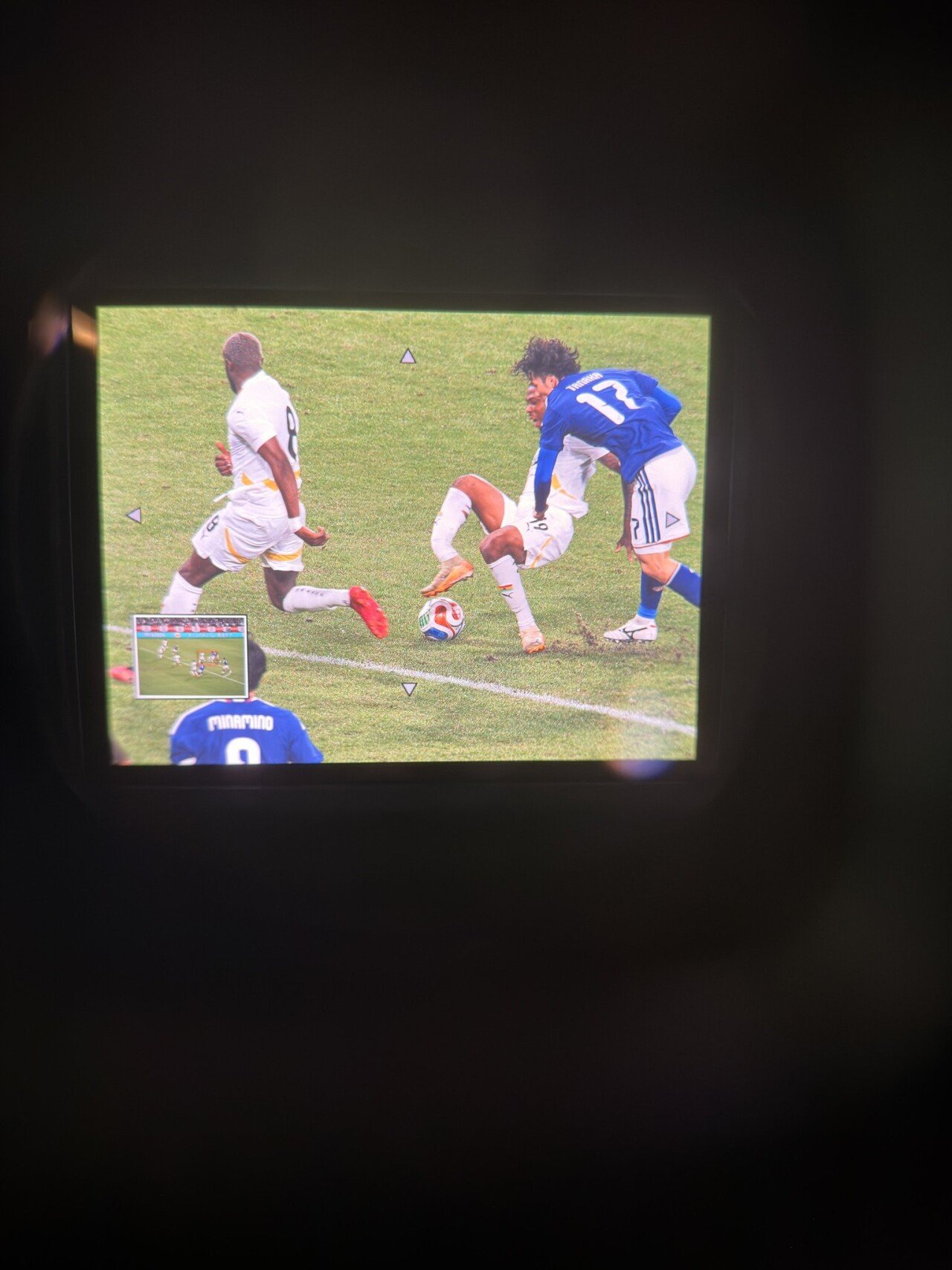 혐) 가나 프란시스 아부 발목 골절