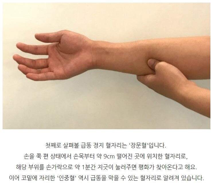 급똥 막는 혈 후기